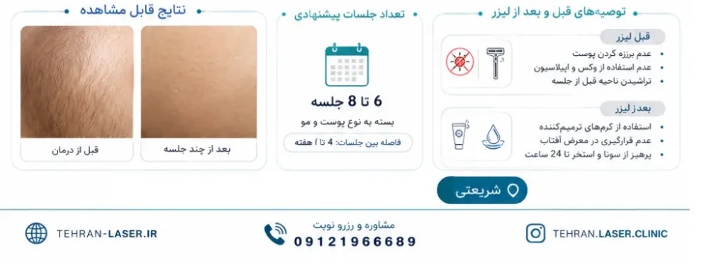 مراقبتهای بعد از لیزر الیت پلاس