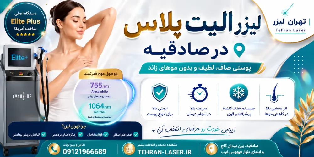 لیزر الیت پلاس در صادقیه